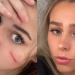 The Tiktok Controversy Of Scar Girl