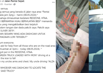 Malaysian Man’s Arm Struck by Flying Rod from Lorry