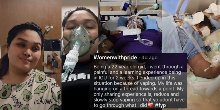 “My Life Was Hanging by a Thread” — 22-Year-Old Vaped into ICU