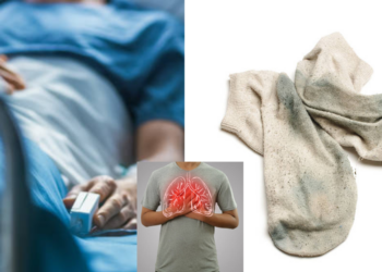 Man Hospitalized for Fungal Lung Infection After Smelling His Dirty Socks Daily