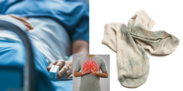 Man Hospitalized for Fungal Lung Infection After Smelling His Dirty Socks Daily