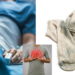 Man Hospitalized for Fungal Lung Infection After Smelling His Dirty Socks Daily