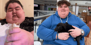 Turkish Mukbang Influencer, 24, Dies After Battling Obesity