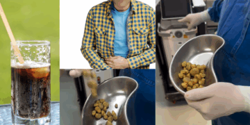 Doctors Remove 35 Bladder Stones From Man Who Drank 3 Liters of Cola a Day