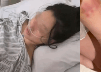 Woman Attacked in Parking Lot, Breast Implants Saved Her from Fatal Injuries