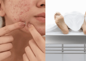Teenage Girl in Vietnam Dies from Severe Infection After Popping Pimples