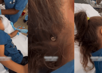 Palestinian Child Survives Israeli Drone Bullet as Gaza’s Death Toll Soars