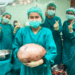 Thai Woman’s “Big Belly” Turns Out to Be an 8kg Ovarian Cyst