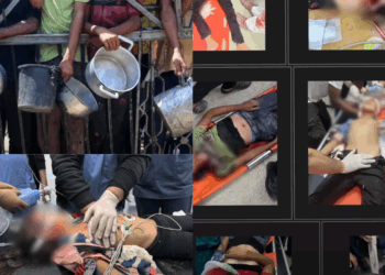 95 Out of 160 Gaza Children Shot in Head or Chest by Israel, Report Finds