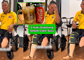 Malaysian Man Loses Both Legs After Nightly Consumption of Soft Drinks Mixed With Condensed Milk