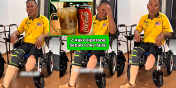 Malaysian Man Loses Both Legs After Nightly Consumption of Soft Drinks Mixed With Condensed Milk