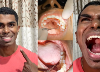 33-Year-Old Man Sets World Record With 42 Teeth—10 More Than Normal