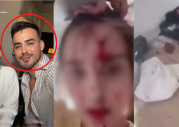 Miss Venezuela 2025 Accuses Celebrity Stylist After Bloody Cannes Hotel Incident