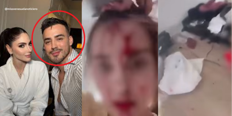 Miss Venezuela 2025 Accuses Celebrity Stylist After Bloody Cannes Hotel Incident