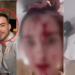 Miss Venezuela 2025 Accuses Celebrity Stylist After Bloody Cannes Hotel Incident