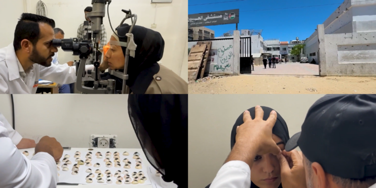 Gaza Hospital Provides Artificial Eyes For War Survivors Amid Severe Medical Shortages Crisis