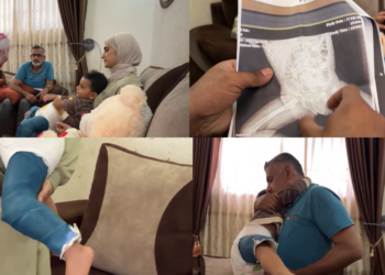 Palestinian mother recounts toddler’s complex surgery amid collapsing health system
