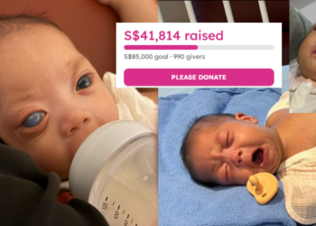Help Baby Gia Khang, Born With Congenital Glaucoma, Raise S$85k To Save His Vision
