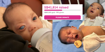 Help Baby Gia Khang, Born With Congenital Glaucoma, Raise S$85k To Save His Vision