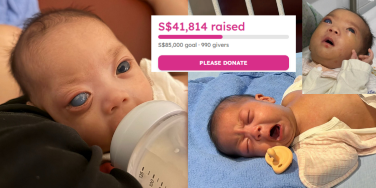 Help Baby Gia Khang, Born With Congenital Glaucoma, Raise S$85k To Save His Vision