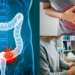 Malaysian Study Says Colon Cancer No Longer Affects Only Older Adults, But Younger People Too