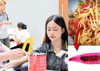 Over 4,000 Isaan University Freshmen Test Positive For Liver Flukes Linked To Raw Fish