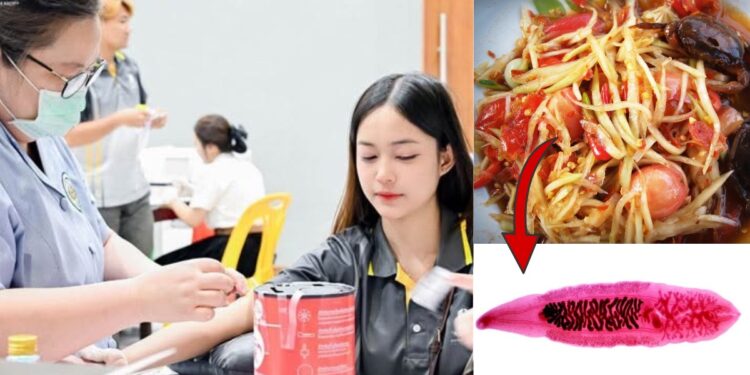 Over 4,000 Isaan University Freshmen Test Positive For Liver Flukes Linked To Raw Fish