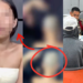 Thai Bar Manager Allegedly Shaves 18-Year-Old Bald Over Unpaid S$2,300 Drinking Bill